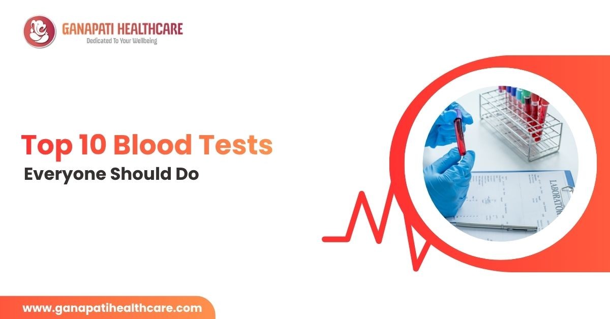 Top 10 Blood Tests Everyone Should Do