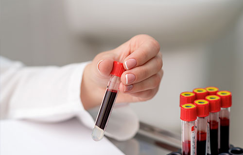 Complete Blood Count