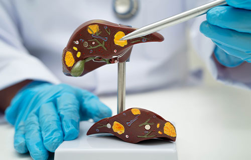Liver Function Tests (LFT)